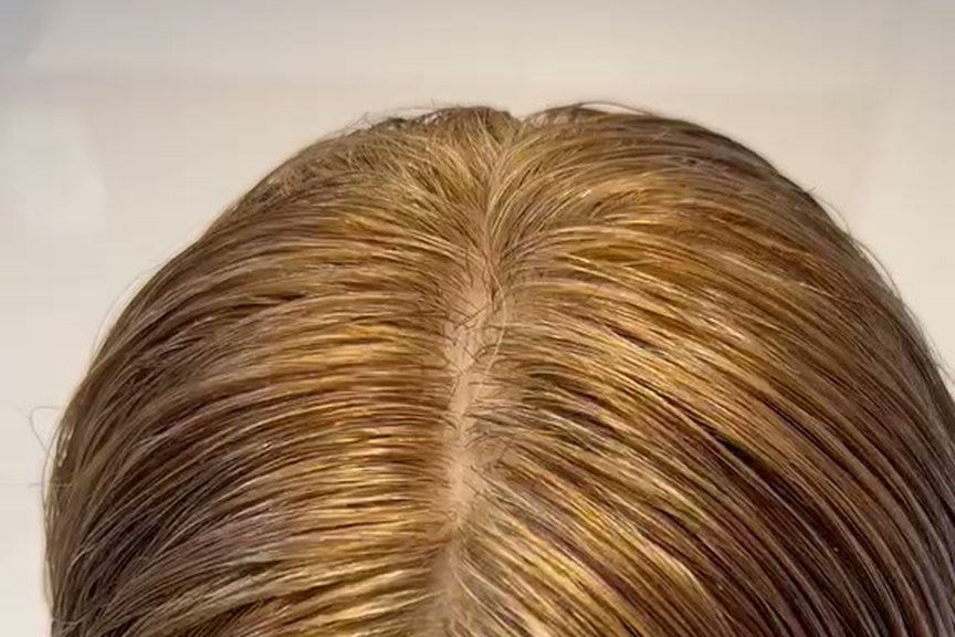 Close-up of an injected parting on a hair piece by Eva Spiess